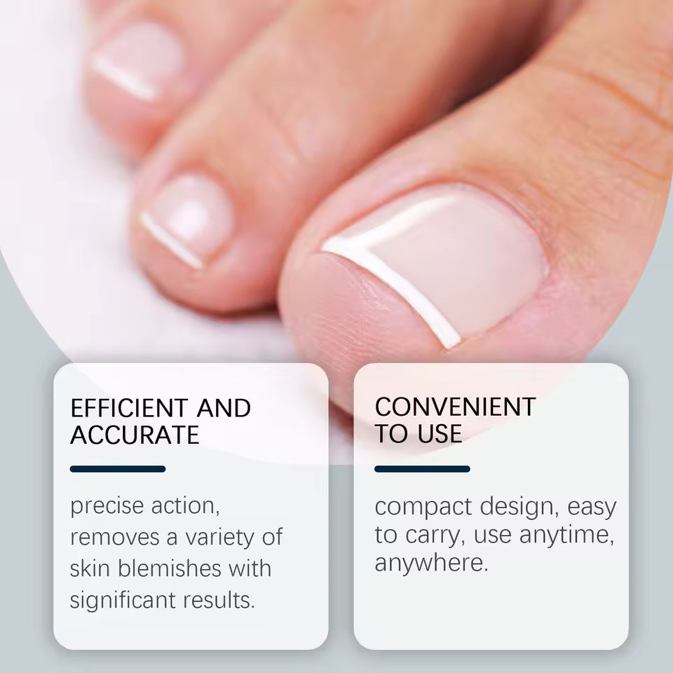Gezonde Nagels Apparaat